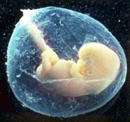 Human unborn baby in the amniotic sac. Photo courtesy Films for Christ ©