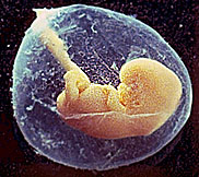 Human fetus. Copyrighted, Films for Christ.