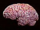 Human brain. Copyrighted, Films for Christ.