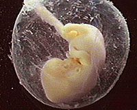 Human fetus. Photo copyrighted, Films for Christ.